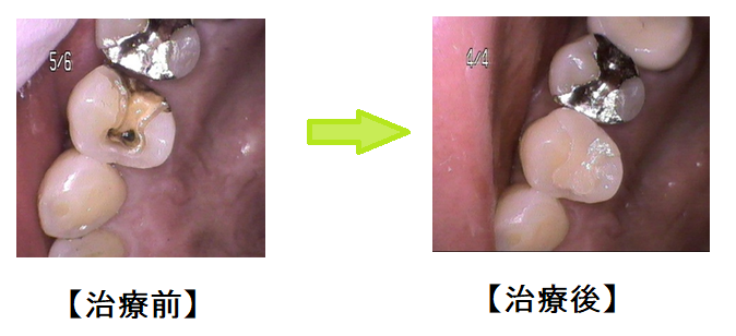 治療前後は写真を撮り、説明しています